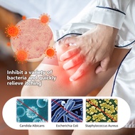 ubat gatal kemaluan Gatal kemaluan Miss v gatal Ubat keputihan Antifungal cream Itching Cream Privat