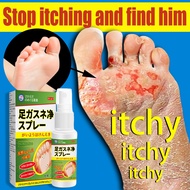Foot Deodorant Spray foot spray anti itch antibacterial spray 35ml Anti-itching Antibacterial and An