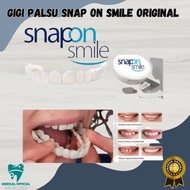 Snap On Smile Venner Gigi Palsu 1 SET (ATAS &amp; BAWAH) Gigi Palsu