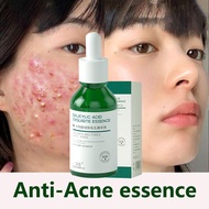30ml Salicylic Acid Fine Pore Removal Essence Whitening and acne removal Blackhead Repair Acne Seal 