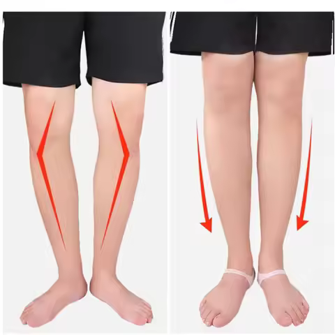 2Pcs O-type Foot Corrector Insoles Pads No Slip Shoes Cushion For Men And Women Silicone Orthopedic 