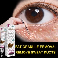 Eye Bag Removing Eye Cream Wrinkle Removing Eye Bag Black Eye Ring Anti Wrinkle gel essence Firming