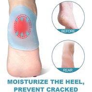 【High-quality】 2pcs Silicone Feet Care Socks Moisturizing Gel Heel Thin Socks With Hole Cracked Foot