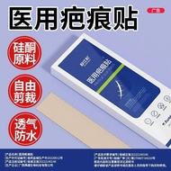 Scar Patch Medical Scar Removal Cream Children Scar Removal Repair Scar Removal Belly Generation Bum