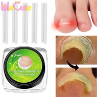 10Pcs Professional Ingrown Toenail Correction Tool / Ingrown Toenail Corrector Pad/ Foot Care Tool