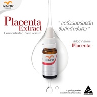 REBIRTH - PLACENTA EXTRACT CONCENTRATE SERUM 25ML. - เซรั่มรกแกะเข้มข้น 25ML. ซึมไวลด ริ้วรอยกระชับผ