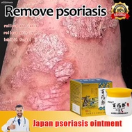 Psoriasis Eczema Bai Yao Lang Cream Anti-Itching Ubat gatal kulit  Antifungal cream