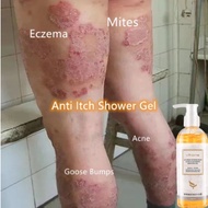 sabun gatal kulit Psoriasis body wash eczema body wash eczema treatment Gatal Kulit treatment eczema