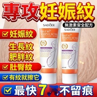 🔥Free Shipping 24H🔥 [Buy 2 Get 1 Free] Stretch Mark Cream Light Mark Cream Stretch Mark Growth Mark 