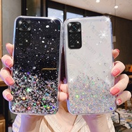 Redmi Note 11 Pro Transparent Glitter Bling Phone Case Redmi Note 11S Soft Silicone Clear Back Cover