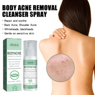 Eelhoe Back Acne Repair Spray Acne Mark Removal Pimple Scar Anti Itching Redness Oil Control Shrink 