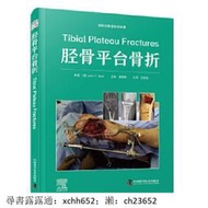 書 正版 脛骨平臺骨折 約翰.T. 里爾 9787523606667
