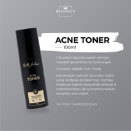 hk2 acne toner / Skincare by dr. Oky Pratama / Bening's skincare /