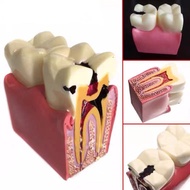 6 times teeth anatomy model for learning competition