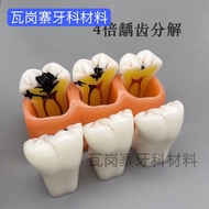 Dental Oral Model 6 Times Teeth Contrast 4 Times Teeth Decomposition 2 Times Teeth Development Evolu