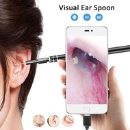 3-in-1 HD ENT Endoscopic Tool, Convenient Phone App Connection