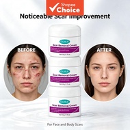 Ouhue Scar Removal Cream   Lightening Cream Post Injury Recovery Essence Uneven Skin Tone Repair Car