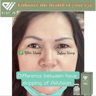 🎈正品🎈👀Aiivision Hydrating Liqiud 🏅原装正品现货🎁爱美视润眼液📣KKM&SGS Approved:眼部救星/眼干/红血丝/青光眼/白内障/远视/近视👓