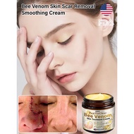 【Visible Scar Reduction】HFH Bee Venom Scar Removal Cream For Smooth Skin Repair / Effective Blemish 