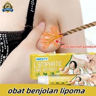 Lymphatic detox removal cream Benjolan Limfoma lymphatic drainage Lipoma Removal Cream Underarm Neck