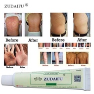 💯%Original Eczema treatment Anti bacterial skin fungus 藏药皮宝kurap/