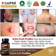 Obat Bisul Obat Bisul Di Wajah Obat Bisul Di Ketiak Obat Bisul Bernanah Obat Bisul Di Pantat