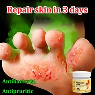 Eczema Treatment Cream Original Psoriasis Cream Potent Treatment Eczema Itchy Skin and Allergy Anti 