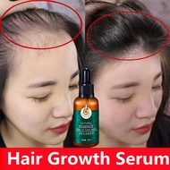 Hair Growth Serum serum rambut gugur Fast Hair Growth Essential Oil Hair Growth Hair fall Rescue Pre