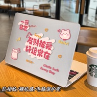 Fortune macbookair Protective Case Air13.6 M4air15A3241 Transparent macbook Protective Case Apple A3