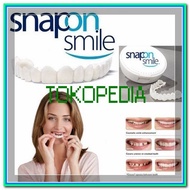 Snap On Smile 100% ORIGINAL Authentic Snap 'n Smile Gigi Palsu Elegan