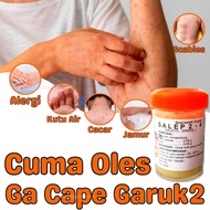 Salep Kutu Air Pada Sela Jari Kaki dan Tangan Obat Jamur Kulit Kutu Air  Salep Gatal2 yg Paling Ampu