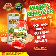 Pure Kasoy Oil Warts Remover