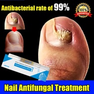 Ubat Kulat Kuku Nail Fungus Treatment Liquid Ubat Kuku Cekam Fungal Nail Treatment Ubat Kuku Rosak F