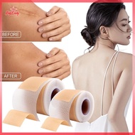 NFPH> Silicone Scar Patch Nude Scar Tape Roll Scar Sheet Removal Self-Adhesive Tape Patch Burn Acne 
