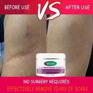 COD【Fast delivery】peklat remover cream original acne scar remover peklat remover scar remover for ol