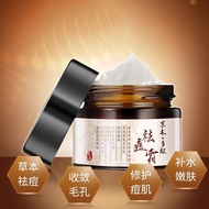 outlet 草本祛痘霜 控油祛痘膏 Herbal acne cream oil control acne removing cream to remove acne acne essence.