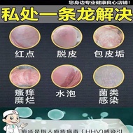 尖锐湿疣药膏珍珠疹软下疳男女性病疣梅毒HSV感染水泡溃疡红斑疹Acuteness wet wart cream pearl23.6.17