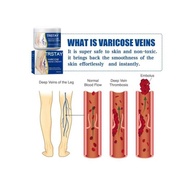 ✖  Leg vein repair cream Varicose massage earthworm leg pain swelling Huoluomaikang antibacterial topical cream