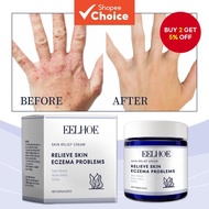 Anti-Itch Skin Cream Safe and Natural Relief for Itching Eczema Peeling Redness and Rashes Gentle on