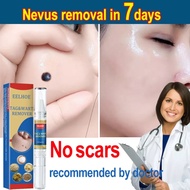 [Loại Xịn] TAG&WART REMOVER  tẩy nốt ruồi xóa mụn ruồi trên mặt tàn nhang mụn cóc mụn thịt  mụn cơm 