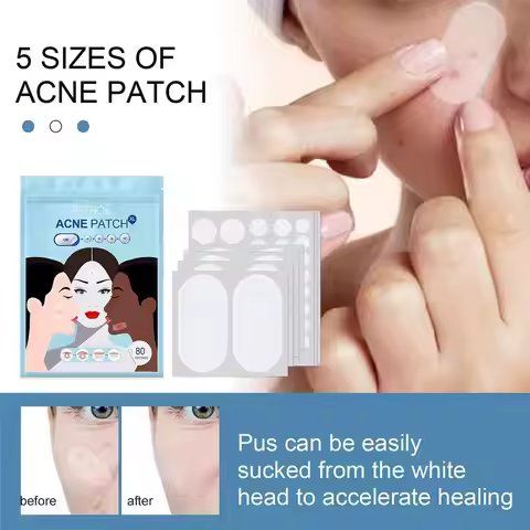 80pcs/set Large Size Acne Patch Acne Pimple Patch Face Treatment Remover Stickers Invisible Pimples 