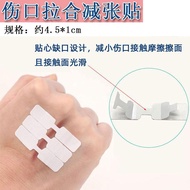 Stitch-Free Sticker Zipper Band-Aid Zipper Type Stitch-Free Wound Sticker Tape Stitching Reducing St