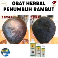 Minyak Kelapa Penumbuh Rambut Botak Minyak Kelapa SR12 BPOM Original Minyak Kelapa Penyubur Rambut R