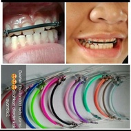THAILAND BRACES REMOVABLE braces wax