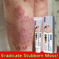South Moon Atoderma Cream Original Gamot sa kati kati sa balat ointment eczema treatment cream biode