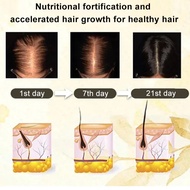 Hair Tonic with Rolling Ball Essence Prevent Hair Loss Nourish Hair Roots