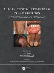 Atlas of Clinical Dermatology in Coloured Skin P C Das