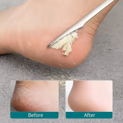 1/2/5pcs Manicure Pedicure Tool Toe Nail Shaver Feet Pedicure Knife Kit Foot Callus Rasp File Dead S