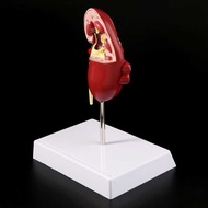 LY   Props Model Life Size Human Kidney Diseased Anatomical Andiseased Pathological Stone