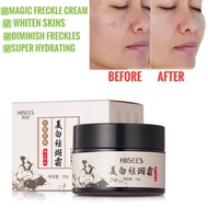 HIISEES Freckle cream whitening cream Krim Pemutih Bintik gelap美白祛斑霜